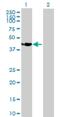 Single Stranded DNA Binding Protein 4 antibody, H00170463-B01P, Novus Biologicals, Western Blot image 