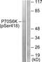 Ribosomal Protein S6 Kinase B2 antibody, PA5-38308, Invitrogen Antibodies, Western Blot image 