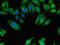 N-Acetylated Alpha-Linked Acidic Dipeptidase Like 2 antibody, CSB-PA704507LA01HU, Cusabio, Immunofluorescence image 