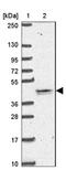 Transmembrane protein 79 antibody, NBP2-47601, Novus Biologicals, Western Blot image 