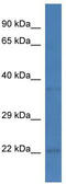 PEST Proteolytic Signal Containing Nuclear Protein antibody, TA344793, Origene, Western Blot image 