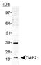 Transmembrane P24 Trafficking Protein 10 antibody, TA336525, Origene, Western Blot image 