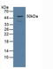 Proteasome 26S Subunit, Non-ATPase 5 antibody, LS-C713562, Lifespan Biosciences, Western Blot image 