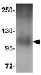 Pleckstrin Homology And RUN Domain Containing M1 antibody, GTX17056, GeneTex, Western Blot image 