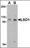 Lysine Demethylase 1A antibody, orb89161, Biorbyt, Western Blot image 