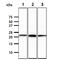 Natural Cytotoxicity Triggering Receptor 3 antibody, GTX57732, GeneTex, Western Blot image 