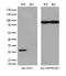 Nitrilase Family Member 2 antibody, M05891, Boster Biological Technology, Western Blot image 