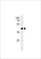 Transcription Factor AP-2 Delta antibody, TA325179, Origene, Western Blot image 