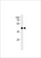 Transcription Factor AP-2 Delta antibody, TA325179, Origene, Western Blot image 