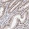 Nucleoporin 153 antibody, NBP1-81723, Novus Biologicals, Immunohistochemistry paraffin image 
