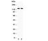 Integrin Subunit Alpha E antibody, R30704, NSJ Bioreagents, Western Blot image 