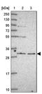 Ring Finger Protein 170 antibody, PA5-62270, Invitrogen Antibodies, Western Blot image 