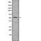Calcium/Calmodulin Dependent Protein Kinase II Alpha antibody, abx148846, Abbexa, Western Blot image 