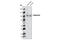 Gamma-Aminobutyric Acid Type B Receptor Subunit 2 antibody, 3839S, Cell Signaling Technology, Western Blot image 