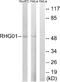 Rho GTPase Activating Protein 1 antibody, A06116, Boster Biological Technology, Western Blot image 