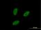 Interleukin 1 Receptor Associated Kinase 1 Binding Protein 1 antibody, H00134728-B01P, Novus Biologicals, Immunofluorescence image 