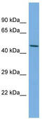 Lymphotoxin Beta Receptor antibody, TA329151, Origene, Western Blot image 