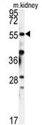 Peptidyl-prolyl cis-trans isomerase FKBP1B antibody, AP17388PU-N, Origene, Western Blot image 