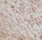 PDZ Binding Kinase antibody, FNab06180, FineTest, Immunohistochemistry frozen image 