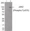 Janus Kinase 2 antibody, 79-790, ProSci, Western Blot image 
