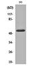 Matrix Metallopeptidase 14 antibody, orb159387, Biorbyt, Western Blot image 