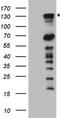 Poly(ADP-Ribose) Glycohydrolase antibody, LS-C794396, Lifespan Biosciences, Western Blot image 