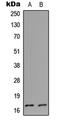 Cystatin Like 1 antibody, abx121586, Abbexa, Western Blot image 