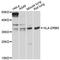 Major Histocompatibility Complex, Class II, DR Beta 5 antibody, LS-C747811, Lifespan Biosciences, Western Blot image 