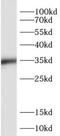 SIX Homeobox 1 antibody, FNab07886, FineTest, Western Blot image 