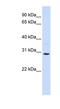 Solute Carrier Family 25 Member 20 antibody, NBP1-59574, Novus Biologicals, Western Blot image 