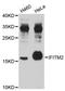 Interferon Induced Transmembrane Protein 2 antibody, A4438, ABclonal Technology, Western Blot image 