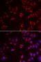 Melanoma antigen preferentially expressed in tumors antibody, STJ28539, St John