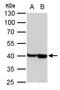 Actin Alpha Cardiac Muscle 1 antibody, TA308841, Origene, Western Blot image 