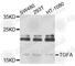 Transforming Growth Factor Alpha antibody, A0337, ABclonal Technology, Western Blot image 