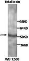 Retinoic Acid Receptor Alpha antibody, orb77177, Biorbyt, Western Blot image 