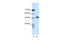 COP9 Signalosome Subunit 2 antibody, 28-026, ProSci, Western Blot image 