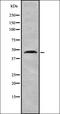 Cytochrome B561 Family Member D2 antibody, orb337437, Biorbyt, Western Blot image 