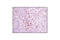 Minichromosome Maintenance Complex Component 3 antibody, 4012S, Cell Signaling Technology, Immunohistochemistry paraffin image 
