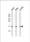 Ribosomal Protein Lateral Stalk Subunit P1 antibody, PA5-49548, Invitrogen Antibodies, Western Blot image 