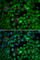 Transcription Factor EB antibody, A7311, ABclonal Technology, Immunofluorescence image 