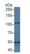 Integrin Subunit Alpha 3 antibody, LS-C700363, Lifespan Biosciences, Western Blot image 