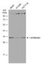 V-type proton ATPase subunit E 1 antibody, NBP2-15520, Novus Biologicals, Western Blot image 