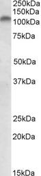 Polo Like Kinase 4 antibody, EB05336, Everest Biotech, Western Blot image 