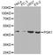 Phosphoglycerate Kinase 1 antibody, A14039, ABclonal Technology, Western Blot image 