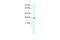 Chloride Voltage-Gated Channel 5 antibody, 28-263, ProSci, Western Blot image 