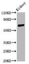 CD2 Associated Protein antibody, LS-C682285, Lifespan Biosciences, Western Blot image 