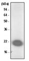 Parkinsonism Associated Deglycase antibody, SM6031S, Origene, Western Blot image 