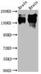 Neurotrophic Receptor Tyrosine Kinase 1 antibody, CSB-RA202683A0HU, Cusabio, Western Blot image 