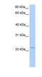 Annexin A2 Receptor antibody, NBP1-53077, Novus Biologicals, Western Blot image 