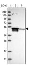 TRNA Splicing Endonuclease Subunit 2 antibody, NBP1-81141, Novus Biologicals, Western Blot image 